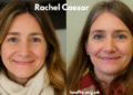 Rachel Caesar: Powerful Advocate for Women’s Empowerment — Inspiring Growth and Facing Challenges Rachel Caesar
